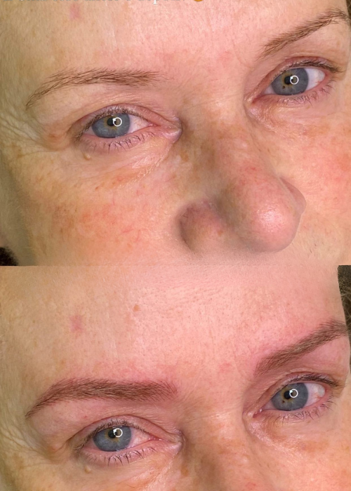 Micropigmentação labial