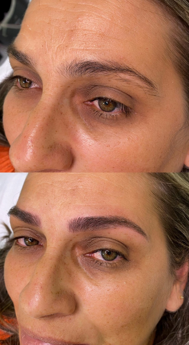 Contorno labial