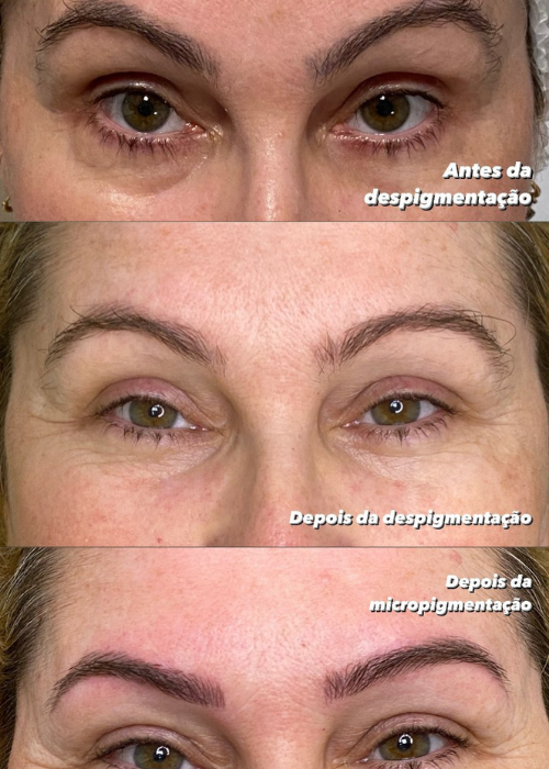 Revitalização labial