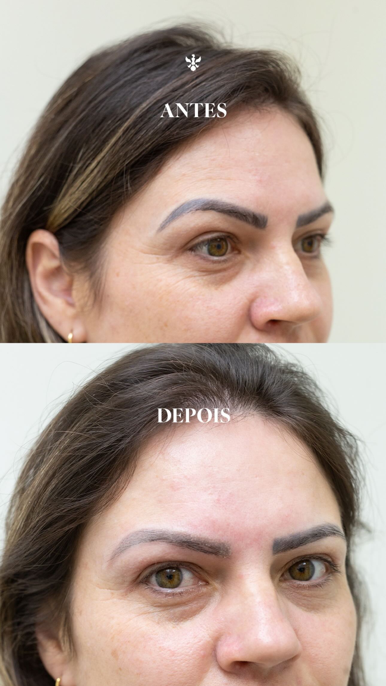 Renovação completa