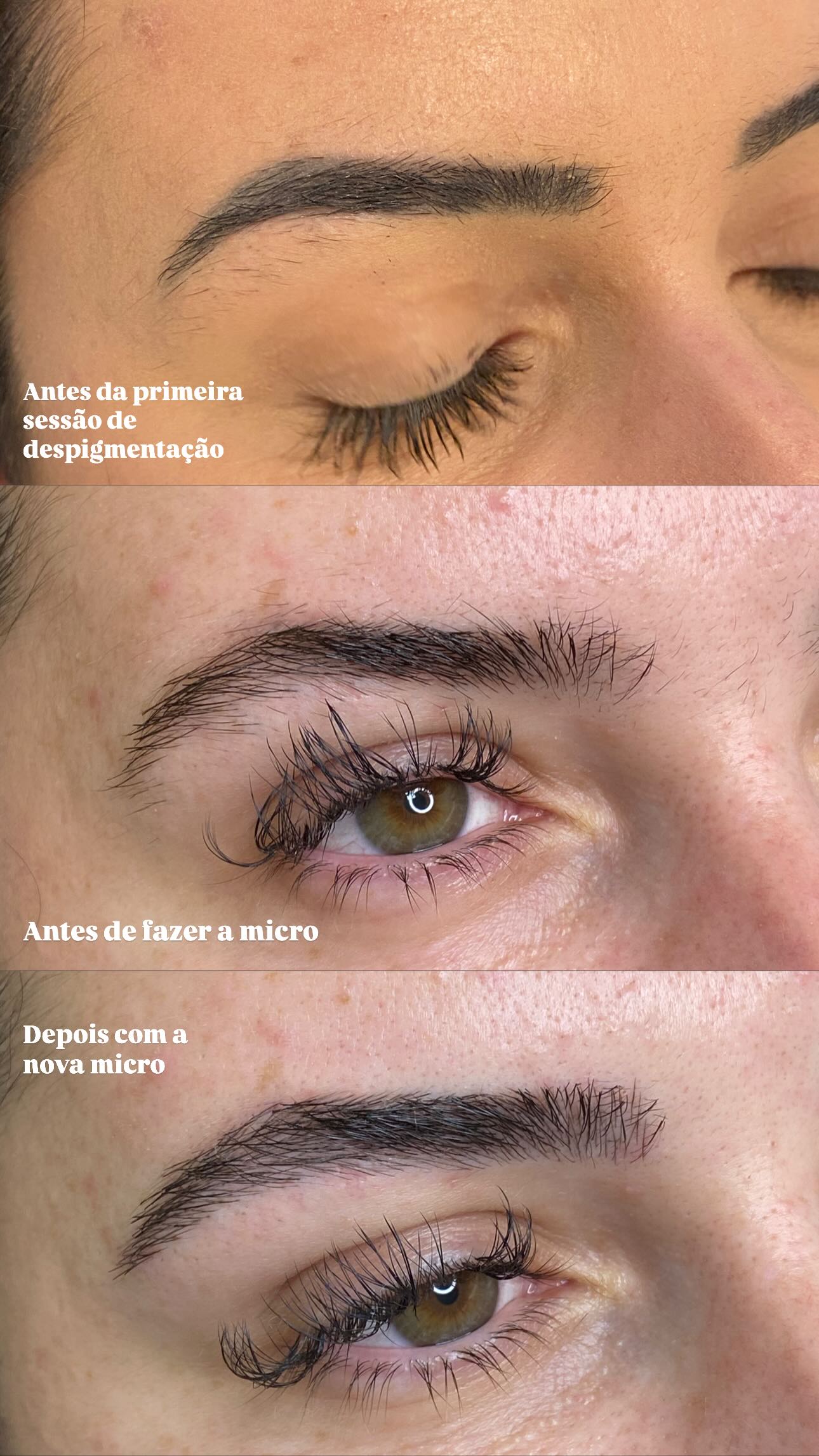 Resultado natural